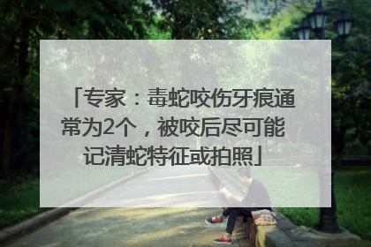 专家：毒蛇咬伤牙痕通常为2个，被咬后尽可能记清蛇特征或拍照