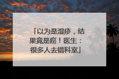 以为是湿疹，结果竟是癌！医生：很多人去错科室